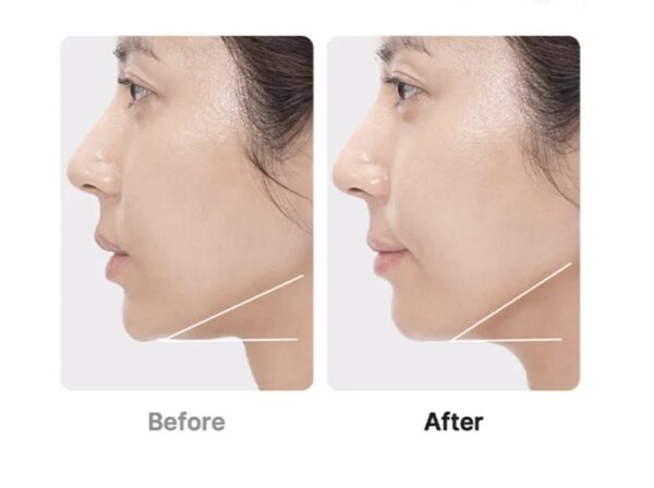 Age R-Booster Pro de Medicube - 1 Pieza